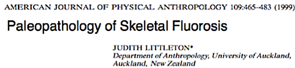 Paleopathology of Skeletal Fluorosis m