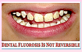 dental F. not revers..